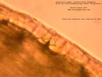 005_utri_gibba_M03_k.jpg
